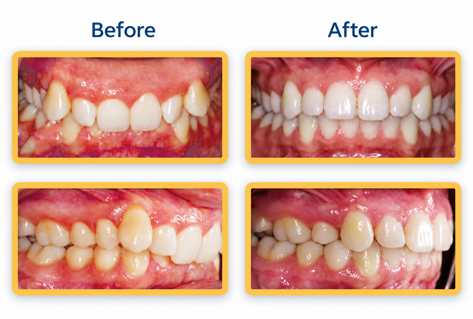 Before and after general dental treatment