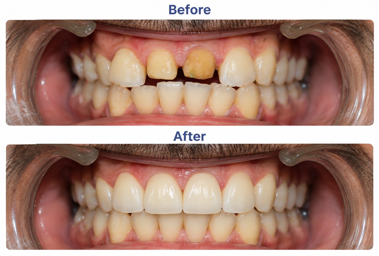 Before and after dental treatment